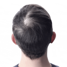 Load image into Gallery viewer, Hårserum for hodebunnen | Behandling for tynt hår - tekshop.no