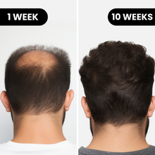 Load image into Gallery viewer, Hårserum for hodebunnen | Behandling for tynt hår - tekshop.no