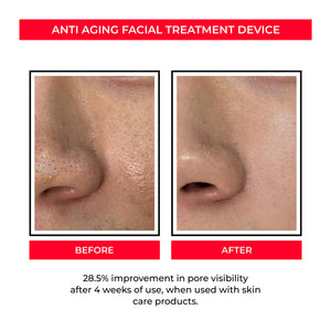 Anti-age Booster, Fresh Lift og EMS rynkefjerner