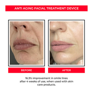 Anti-age Booster, Fresh Lift og EMS rynkefjerner