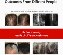 Load image into Gallery viewer, Rødlys-caps for hårvekst — Målrettet behandling hjemme - tekshop.no