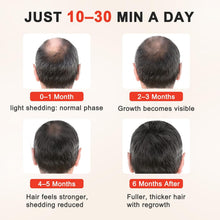 Load image into Gallery viewer, Rødlys-caps for hårvekst — Målrettet behandling hjemme - tekshop.no