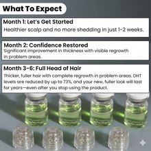 Load image into Gallery viewer, Hårserum for hodebunnen | Behandling for tynt hår - tekshop.no