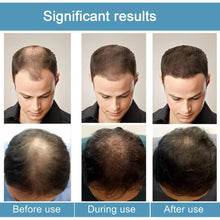 Load image into Gallery viewer, Hårserum for hodebunnen | Behandling for tynt hår - tekshop.no