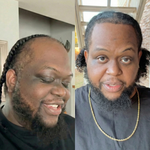 Load image into Gallery viewer, Hårserum for hodebunnen | Behandling for tynt hår - tekshop.no