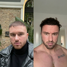 Load image into Gallery viewer, Hårserum for hodebunnen | Behandling for tynt hår - tekshop.no