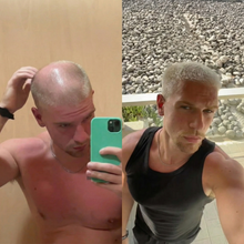 Load image into Gallery viewer, Hårserum for hodebunnen | Behandling for tynt hår - tekshop.no