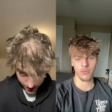 Load image into Gallery viewer, Hårserum for hodebunnen | Behandling for tynt hår - tekshop.no