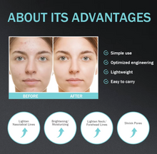 Load image into Gallery viewer, Anti-age Booster, Fresh Lift og EMS rynkefjerner