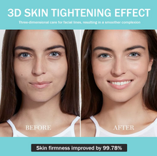 Load image into Gallery viewer, Anti-age Booster, Fresh Lift og EMS rynkefjerner