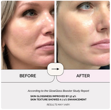 Load image into Gallery viewer, Anti-age Booster, Fresh Lift og EMS rynkefjerner