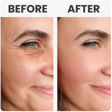 Load image into Gallery viewer, Anti-age Booster, Fresh Lift og EMS rynkefjerner