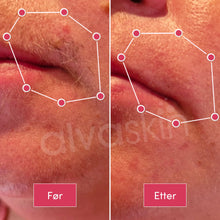 Load image into Gallery viewer, 2-i-1 Epilator og Barbermaskin | Langvarig glatt hud - tekshop.no
