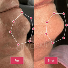 Load image into Gallery viewer, 2-i-1 Epilator og Barbermaskin | Langvarig glatt hud - tekshop.no
