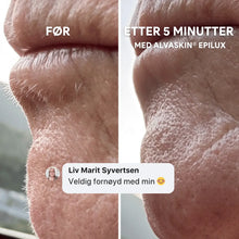 Load image into Gallery viewer, 2-i-1 Epilator og Barbermaskin | Langvarig glatt hud - tekshop.no