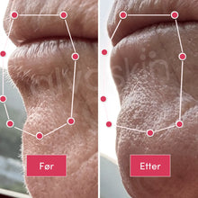 Load image into Gallery viewer, 2-i-1 Epilator og Barbermaskin | Langvarig glatt hud - tekshop.no