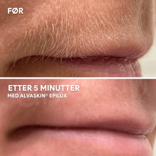 Load image into Gallery viewer, 2-i-1 Epilator og Barbermaskin | Langvarig glatt hud - tekshop.no