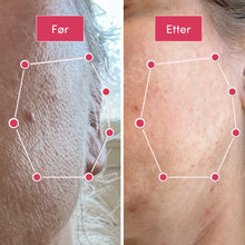 Load image into Gallery viewer, 2-i-1 Epilator og Barbermaskin | Langvarig glatt hud - tekshop.no