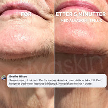 Load image into Gallery viewer, 2-i-1 Epilator og Barbermaskin | Langvarig glatt hud - tekshop.no