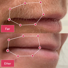 Load image into Gallery viewer, 2-i-1 Epilator og Barbermaskin | Langvarig glatt hud - tekshop.no