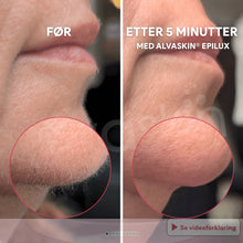 Load image into Gallery viewer, 2-i-1 Epilator og Barbermaskin | Langvarig glatt hud - tekshop.no
