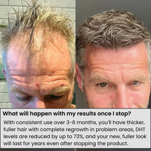 Load image into Gallery viewer, Hårserum for hodebunnen | Behandling for tynt hår - tekshop.no