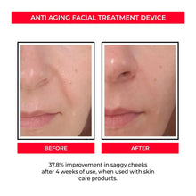 Load image into Gallery viewer, Anti-age Booster, Fresh Lift og EMS rynkefjerner