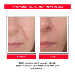 Anti-age Booster, Fresh Lift og EMS rynkefjerner
