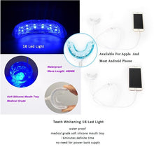 Load image into Gallery viewer, Glory Smile ™ Teeth Whitening Kit tekshop.no