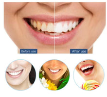 Load image into Gallery viewer, Teeth Cleaner™ Tannsteinfjerner med 5 nivåer - tekshop.no
