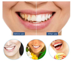 Teeth Cleaner™ Tannsteinfjerner med 5 nivåer - tekshop.no