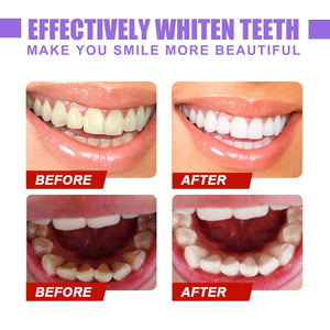 Glory Smile V34 Colour Corrector 30ml Purple Post-Whitening Toothpaste tekshop.no